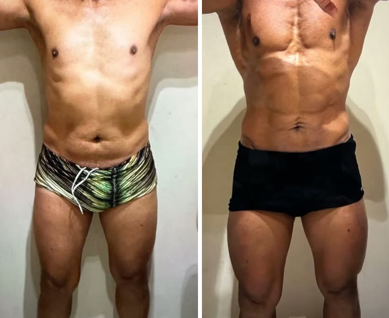 Antes e depois do mesmo cliente idoso no Stimulus Sculp: à direita, abdômen, braços e pernas mais definidos